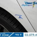 덴트존 이미지