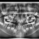 서울에이치과의원 이미지