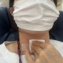 대림 성모병원 갑상선 결절 조직검사(세침검사) 후기