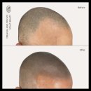 탈모왕 본점 이미지