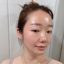 에스테틱 아늑 | [신림 에스테틱] 아늑에스테틱 스피큘 필링 후기: 깐달걀 피부 완성!