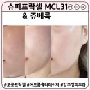멍슈퍼 | 강남] 압구정로데오 피부과 모공 여드름 흉터 레이저 슈퍼프락셀 MCL31 쥬베룩 후기 효과 부작용 주의사항