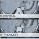 경화식품 이미지