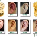귀 건강학(이혈테라피) 네이버블로그