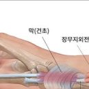 손목 아플 때 6가지 이유는? 찌릿 시큰 등 손목이 아파요 병원 이미지