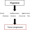 Hyperbaric oxygen therapy and cancer—a review 이미지