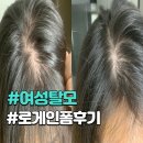 (주)무풍지대 | [탈모 극복기 3탄] 로게인폼 1주일 후기 | 쉐딩은? 탈모약에 희망 걸어봄