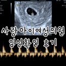 송파 사랑아이여성의원 임신 성공 후기 임신 6주차 심장소리