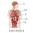 양수색전증[Amniotic fluid embolism] 이미지