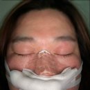 준 이비인후과의원 | 부산 코앤핑 이비인후과 코뼈골절 비관혈적 정복술 당일 입원 수술 비용 및 통증후기