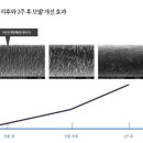 쏘헤어 이미지