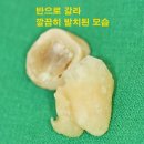 기쁜하루치과의원 이미지