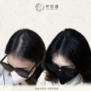 두피움 이미지