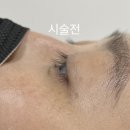 솔븜