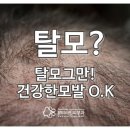 광주탈모치료 알아보고 계세요? 이미지