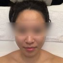 타미나 | 대구 평리동 타미나다 에스테틱 | 스몰페이스 윤곽관리 후기 신부관리 추천