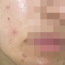 (주)에스닷 | [에스로이 2주년 썸머이벤트] 에스로이 에스테틱 내돈내산 24회 중간 후기