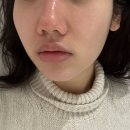 디올에스테틱 | 서현피부관리 디율에스테틱에서 예신 관리받고 왔어요!