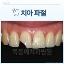 목동예치과병원 이미지