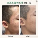 더스무스 왁싱&스킨케어
