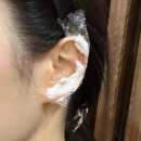 청담스타의원 | 청담피부과 귀필러리터치 리얼후기, 누운귀 자연스러운 필러 정보? 효과!