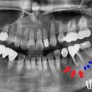 다산바른치과의원 이미지