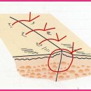 재난대비 상처 봉합술 -4 (실전 봉합술) 이미지