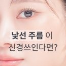 연세리즈의원 이미지