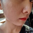 오투에스 이미지