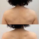 자연을 닮은 집 | 수성구에스테틱 자연을닮은피부관리실 뱀부 스톤 후면관리 후기