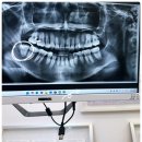 제주아나픈치과의원 | [제주도민추천] 제주시 노형동 아나픈 치과 의원!완전추천합니다 이름처럼 아나파요