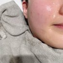 수원피부과 볼뉴머 리프팅 300샷 관리 후기 (오후반차 내고 조용히 다녀온 내돈내산)