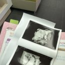 국민건강보험공단 진주산청지사 | 39주 태동검사 초음파 임당 혈당기 소모품 국민건강보험공단 환급