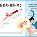 급증하는 통풍 환자들 ㄷㄷㄷ 이미지