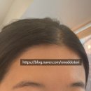차엘브로우 이미지
