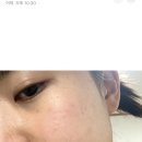 메이듀 모닝듀 모이스쳐 카밍 앰플 에센스 트러블 진정케어 후기