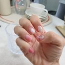 요온네일 이미지