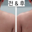바른선 테라피 이미지