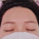모모헤어라인 이미지