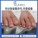 미리케어스