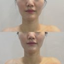후광미인 이미지