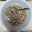복싱대장 | [공지] 알약 대장 내시경 당일 | 용종 제거 : 알약...게이트 2회차.. 그런데 포카리 가루가 살려준..후기
