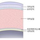 안산미란