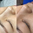 3745 | 동탄 모공관리 [셀리올리 스킨랩] 솔직후기