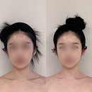 삼영빌딩 | 얼굴작아지는법 위뷰티, 연예인들 다니는 발로하는 윤곽 관리 만족 후기