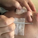 롯데마트 수완점 | 수완지구 피부관리 미플, 등과 얼굴 모두 만족스러운 관리 후기