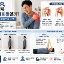 어깨 통증, 오십견일까 회전근개 파열일까? 라운드 숄더까지 확인하는 법 이미지