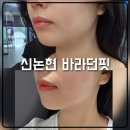 논현2-102 | 신논현피부과 바라던핏 윤곽지방분해주사 이중턱 소멸 후기 효과