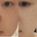 미앤미 | 안동 피부관리샵 미앤미 광나는 피부와 색상이 달라진 후기