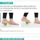 족저근막염 증상 원인 발바닥통증 발뒤꿈치통증 치료방법 스트레칭 자가치료 이미지